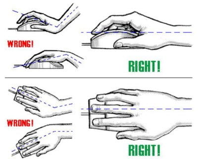 carpal tunnel syndrome prevention
