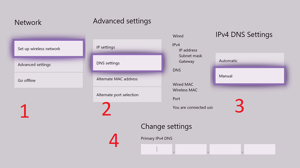 change DNS Server setting on Xbox One