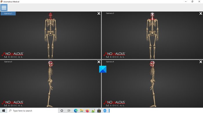 Anomalous Medical human anatomy software