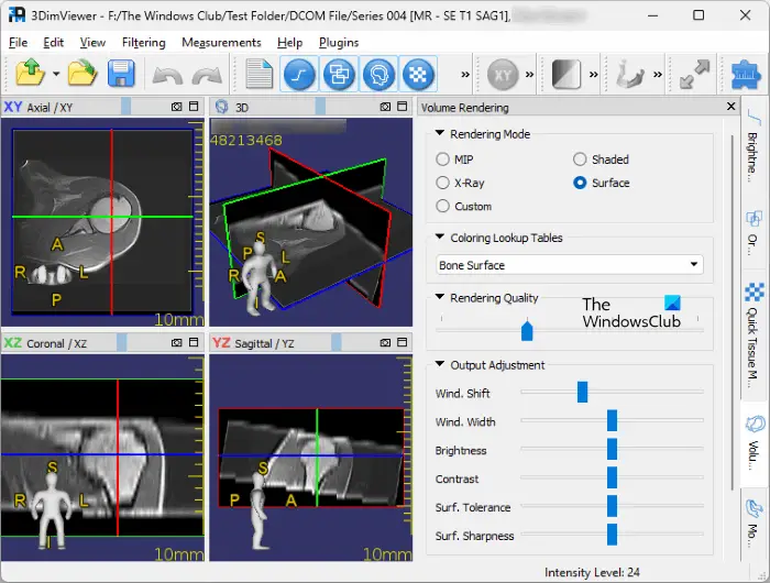 3DimViewer DICOM Viewer software