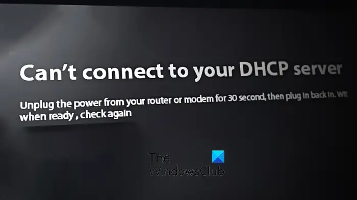 Can't connect to your DHCP server error on Xbox
