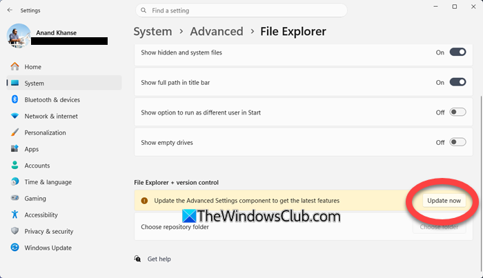 Update the Advanced Settings component to get the latest features